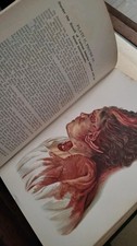 1898 Atlas of Legal Medicine Saunders Hand Atlas - Antique Med Oddities Homicide picture