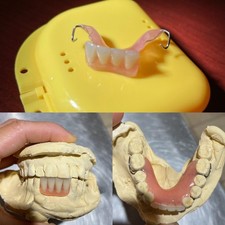 CUSTOM MISSING TEETH FLIPPER/ StayPlate for Upper Lower (Hard Acrylic MATERIAL) picture