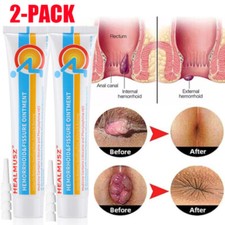 2PCS Herbal Hemorrhoid Cream, Hemorrhoid Treatment, Hemorrhoid Fissure Ointment picture