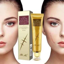 Scar and Acne Mark Removal Gel Ointment Remove Scars Burns Stretch Marks picture