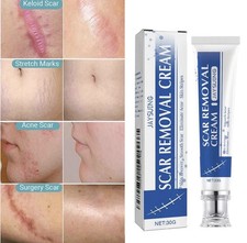 Scar and Acne Mark Removal Gel Ointment Remove Scars Burns Stretch Marks picture