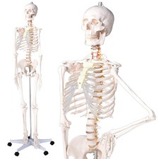 70