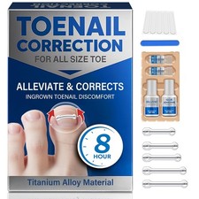 Ingrown Toenail Treatment, Toenail Correction Strips for Curved or Ingrown Nails picture