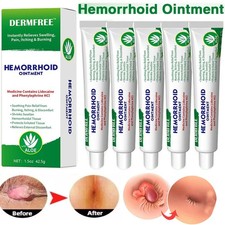 5xHemorrhoid & Fissure Ointment Hemorrhoids Treatment Internal Piles Pain Relief picture